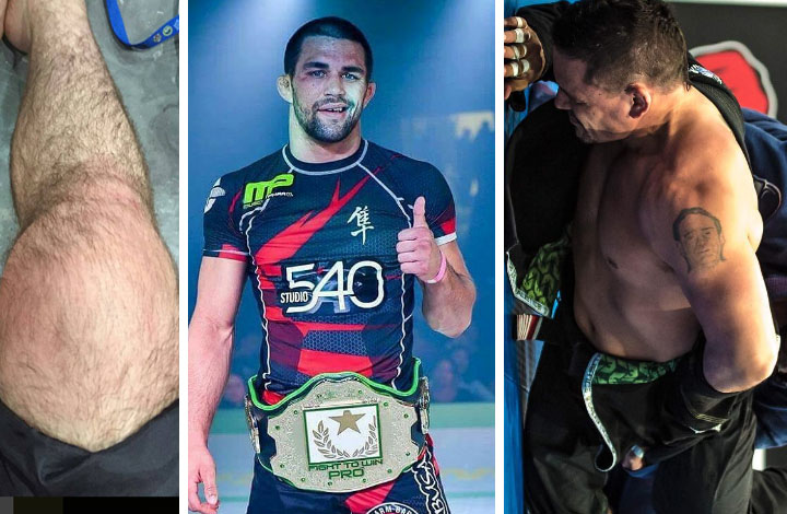 How To Handle Long-Term Grappling Related Pain